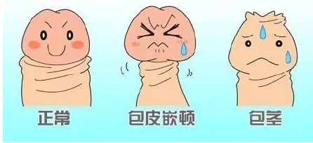 ��Ƥ����Ҫע����Щ