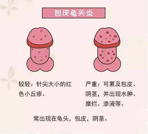 龟头有红点是不是龟头炎